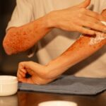 The Science Behind Eczedone: How It Works to Soothe Eczema