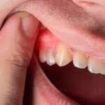 Why Your Gums Hurt: Top Causes of Gum Disease Explained