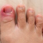 Why Your Toenails Deserve More Attention Than You Think